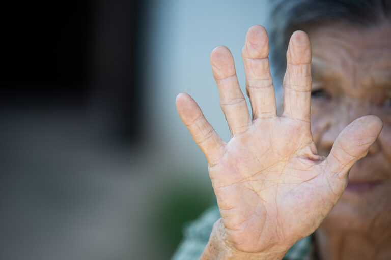 Paciente em reabilitação da Doença de Parkinson com equipe da Clínica Grunvald